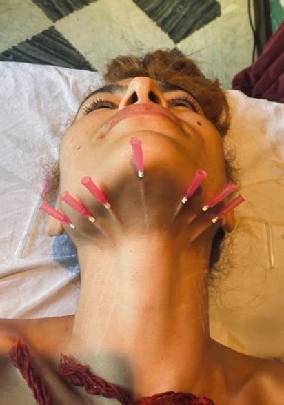 Teraz martwi się o drugą. Atriz Eva Mendes mostra tratamento bizarro e fãs reagem ...