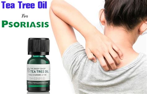 There are a few ways of tea tree oil application for scalp psoriasis sufferers. Tea tree oil for scalp psoriasis - NISHIOHMIYA-GOLF.COM