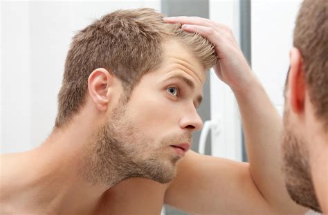 Nutritional factors and hair loss. clinical and experimental dermatology 27.5 (2002): 6 Common Causes of Hair Loss in Men | HEALTHY ESSENTIALS®