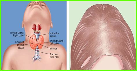 The four phases of hair growth include anagen, catagen, telogen, and exogen. Which Hormones Are Responsible For Boosting Hair Growth ...