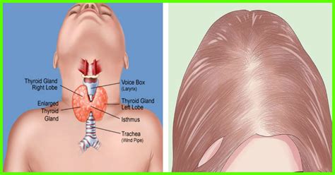 Why has no one been talking about this? Which Hormones Are Responsible For Boosting Hair Growth ...