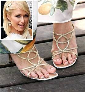 75 voters have answered this question. 8 Beautiful Celebrities with Bunions | New Health Advisor