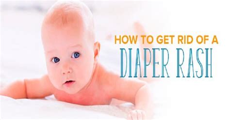 Find Out What Is Diaper Rash And How To Get Rid Of It?