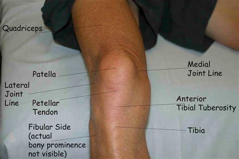 The cause of knee pain: Muscles test 3 - Human Anatomy And Physiology with Alvarez at Southwestern Community College ...