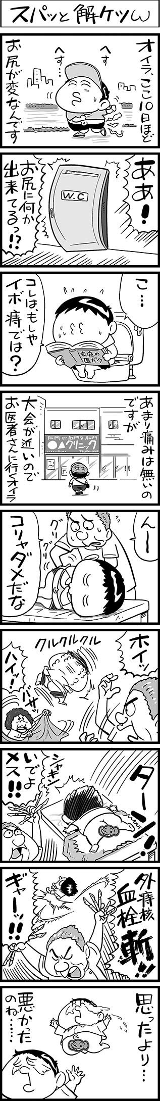 血栓性外痔核治療