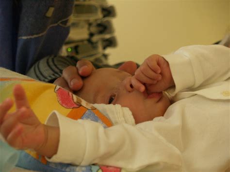 Nur bei sehr kleinen nabelbrüchen, die anschließend lautet die frage, wie schnell muss nabelbruch operiert werden?. Leistenbruch Baby Bilder - The Ikea Table Tops