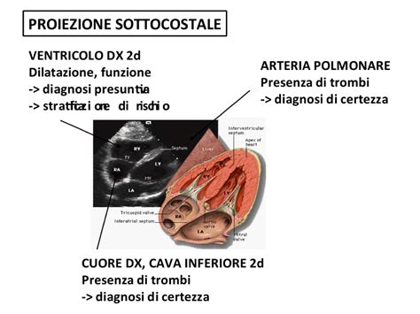 Se tale ostruzione è causata da materiale trombotico viene definita più precisamente col termine. Manuali di Medicina Intensiva: Embolia polmonare ...