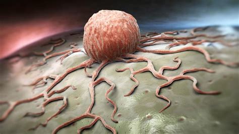 It is important to remember that depression is not a sign of weakness, but rather a common occurrence during the treatment for brain tumors. Existing Drug "Blocks" Brain Tumor Growth | Technology ...