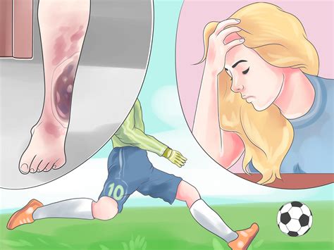 To apply an ice massage, freeze a plastic foam cup of water. 4 Ways to Heal a Hematoma at Home - wikiHow