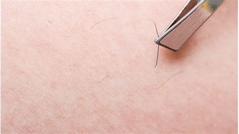 Preventing ingrown facial hairs caused by waxing or plucking. Prevent Ingrown Hair With Tips