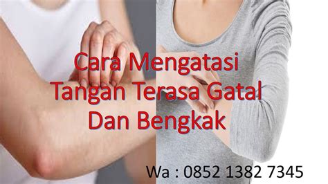 Hal ini disebabkan berbagai faktor. Cara Mengatasi Tangan Terasa Gatal Dan Bengkak - YouTube