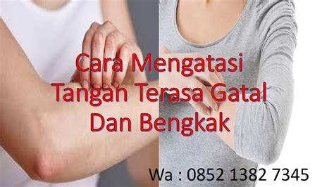 We did not find results for: Cara Mengatasi Tangan Terasa Gatal Dan Bengkak - YouTube