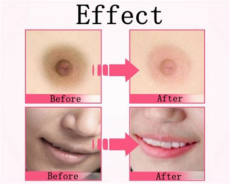 Check out the best cream to lighten dark underarms. AFY Lip Private Part Nipple Bleaching Whitening Fresh Up ...