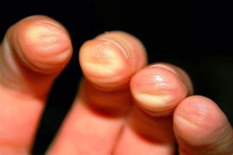 The way experienced guitar players can shred through those insane solos is by developing calluses on their fingers. Tempat Belajar Gitar: Belajar Gitar : Tips Agar Jari Tidak ...