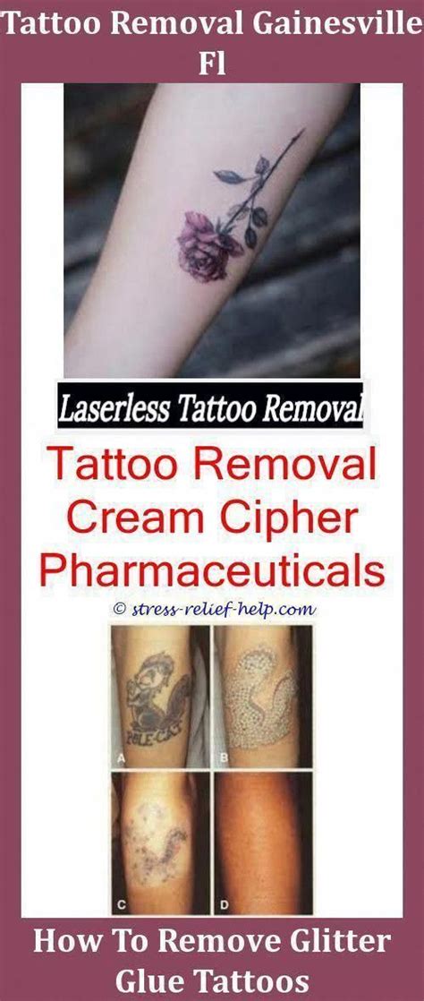 Our treatments include skin tightening, trusculpt 3d, stem cells. Excision Tattoo Removal How Much Would It Cost To Remove A ...