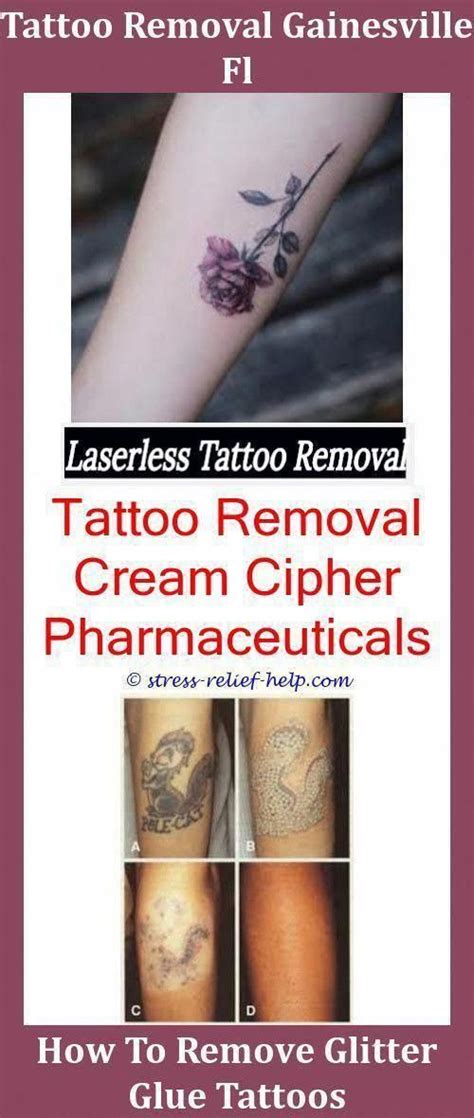 How many laser tattoo removal treatments will i need? Excision Tattoo Removal How Much Would It Cost To Remove A ...