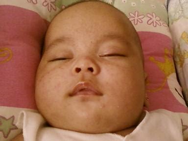 Bibir kering pada bayi bisa disebabkan oleh berbagai penyebab. Cara Menghilangkan Bintik Merah Pada Kulit Pipi Bayi ...