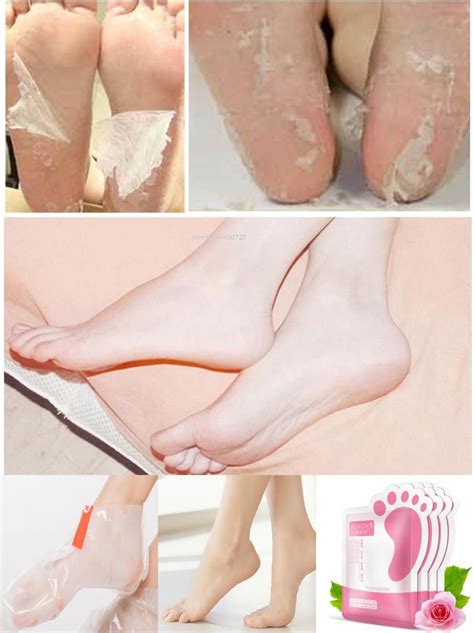 This will help to remove dead skin from feet. Visit to Buy Hot Best Deal Hot Remove Dead Skin Foot ...