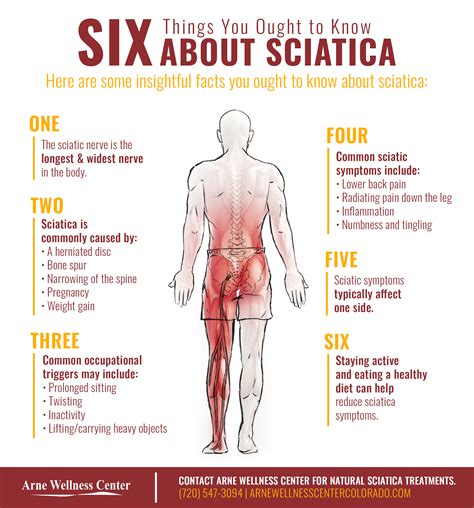 Wondering how to relieve sciatica nerve pain with celery? Sciatica Treatment - Find Relief Through Chiropractic Care ...