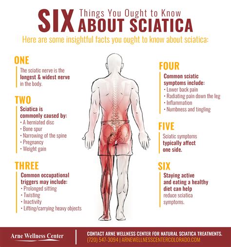 Contentswhat is sciatica?sitting with sciaticahow to sit comfortably with sciatica?best sitting position for sciaticaother ways to sit with sciaticafew tips for good posturea straight spine… Sciatica Treatment - Find Relief Through Chiropractic Care ...