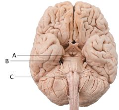 The brainstem lies at the base of the brain and the top of the spinal cord. CH12_ Lecture 2 - cerebral white matter, basal nuclei, diencephalon Flashcards - Cram.com