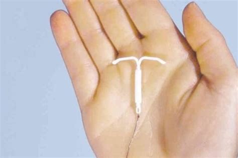 Meaning of iud medical term. arch: non medicated iud meaning