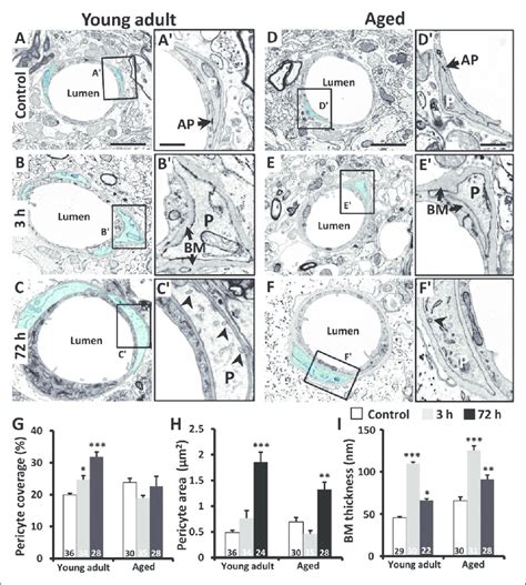 Maybe you would like to learn more about one of these? Effects of ischemia on pericyte area, basement membrane ...