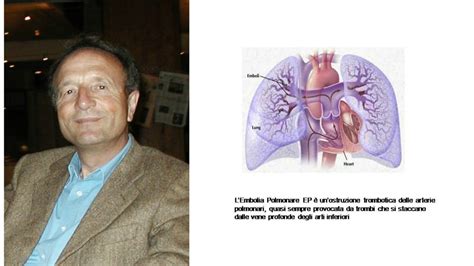 Obesità, età, patologie sono alcune delle cause e dei fattori di rischio. L'embolia polmonare è la causa prevalente della sincope ...