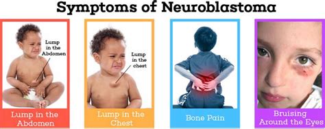 They are often found when a parent or doctor notices that a child's eye looks unusual. Neuroblastoma - Medicaboo Blog