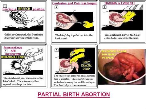 Look up some abortion clinics in your area online. Horrors Of Abortion!