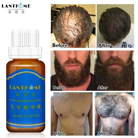 I want to grow hair in face, chest ,hands (like manly) beard growth with 17 year old puberty problems in boy growing facial hair without having testicles? Hair Essence Beard Chest Hair Growth Liquid Nourishing ...