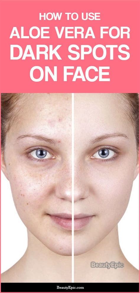 These ingredients work best when paired up, so read labels carefully. How to Use Aloe Vera to Remove Dark Spots on Face? | Dark ...