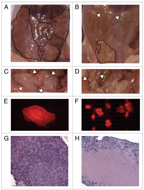 Check spelling or type a new query. Pilot evaluation of human MPM cell lines in a xenograft ...