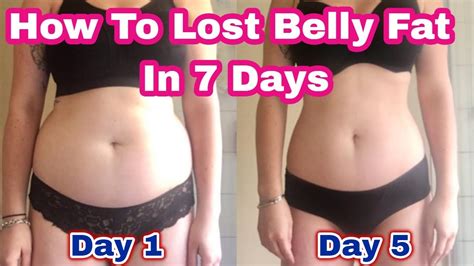 How to fix an overbite at home. How To Lost Belly Fat In 7 Days At Home | Flat Belly Fix ...