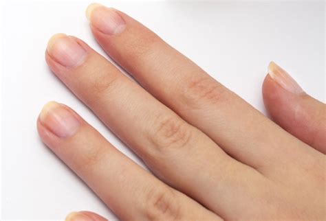巻き爪の原因・予防・切り方・処置― 当院でのご説明について。 午前中の巻き爪矯正外来に来院されるようにお願い申し上げます。 その他の時間は診察の合間に行いますので、なるべく平日にご来院ください。。 ※ 爪が伸びない原因と早く伸ばす方法 - メディカルエンジン