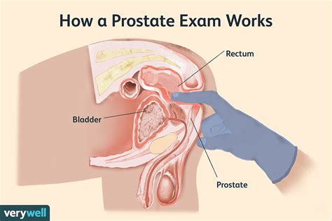 Take the quiz to find out when you will find your true love. What to Expect During a Prostate Exam With Your Doctor
