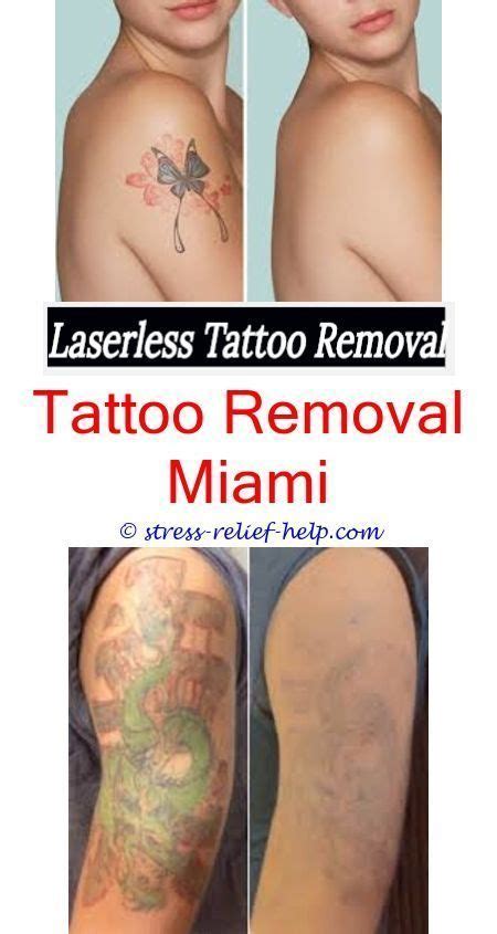 Exfoliate prior to making your tattoo. dermatologist tattoo removal can you get big tattoos removed - tattoo removal before and after ...