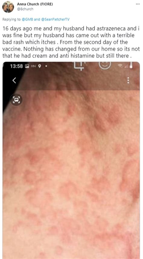 Side effects are one of the key reasons that some remain nervous to get their first or even second dose. Fresh blow for AstraZeneca as vaccine is linked to another ...