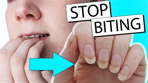 From then on, your child will no longer be able to eat them. Things To Help Stop Biting Nails - NailsTip