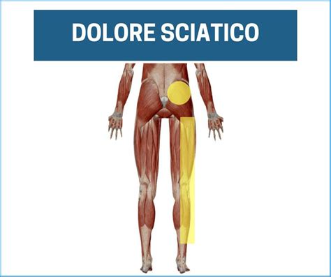 Dolore alla bassa schiena che prende le gambe: ecco perchè ...