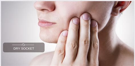 The dry socket leaves underlying nerves exposed, which is very painful. How to Smoke After Tooth Extraction without Getting Dry ...