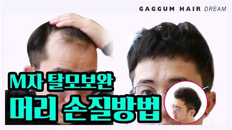 It is also one of the complicated symbols to interpret in dreams, where its interpretation varies significantly along with the context. M자 탈모보완 머리 손질방법 Hair loss style ️ 가꿈헤어드림 gaggum hair dream ...