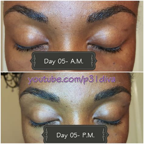 These experts know the best hairstyles for receding hairlines for females that can help disguise thinning patches and make you look younger. 3D Microblading on Dark Skin::Day by Day Journal (Days 01-05) with Pictures