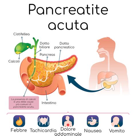 The pancreas is a large organ behind the stomach that produces digestive enzymes and a number of hormones. Pancreatite acuta: sintomi, cause e cura - Valori Normali