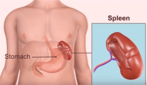 The normal spleen is usually not palpable but is tucked beneath and above the left costal margin, between the fundus of the stomach and the diaphragm, with its long axis parallel to and running along the course of the tenth rib. Enlarged Spleen : symptoms, causes, risk factors and ...