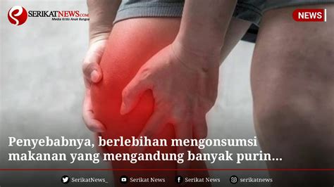 Sehingga kamu perlu berkonsultasi dulu dengan dokter ya, toppers. Info Kesehatan - Resep Alami untuk Mengatasi Asam Urat ...