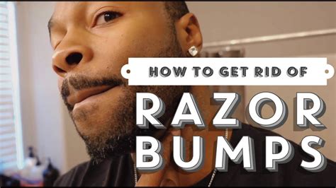 Of course, as murphy's law dictates, this shaving. How to get rid of razor bumps| How to get rid of razor ...