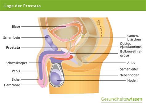 So funktioniert die schonende methode der prostataarterienembolisation. Prostata - Erkrankungen, Untersuchung & Vorbeugung