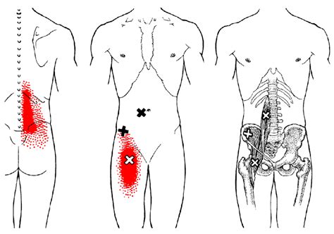 This diagram with labels depicts and explains the details of groin muscles diagram. O que são os Trigger Points e como podem causar Lesões nos Corredores | Pontos de gatilho ...