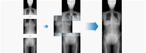 The missing tof camera on the back of the note10 is hardly going to be a dealbreaker for anyone, but we. Digital Radiography AccE GM85 | Samsung Healthcare Global